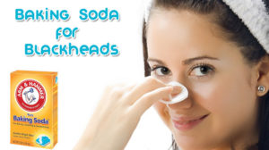 Baking soda treats blackheads