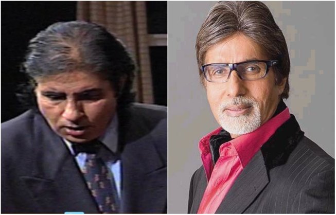 amitabh bachchan hair Transplant